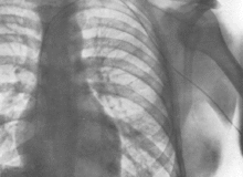 شهامت و شجاعت براي رفتن به داخل قلب