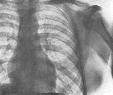 شهامت و شجاعت براي رفتن به داخل قلب