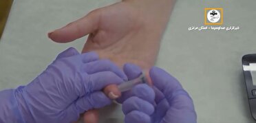 من هم تست اچ‌آی‌وی می‌دهم